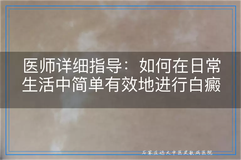 医师详细指导：如何在日常生活中简单有效地进行白癜风自查