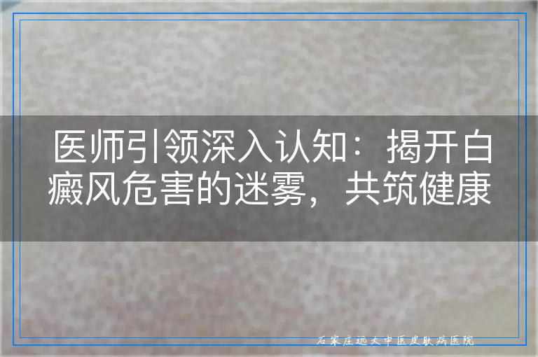 医师引领深入认知：揭开白癜风危害的迷雾，共筑健康防线