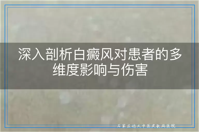 深入剖析白癜风对患者的多维度影响与伤害