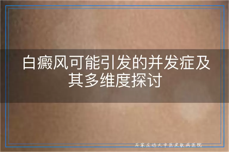 白癜风可能引发的并发症及其多维度探讨
