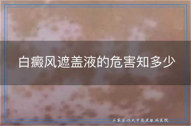 白癜风遮盖液的危害知多少