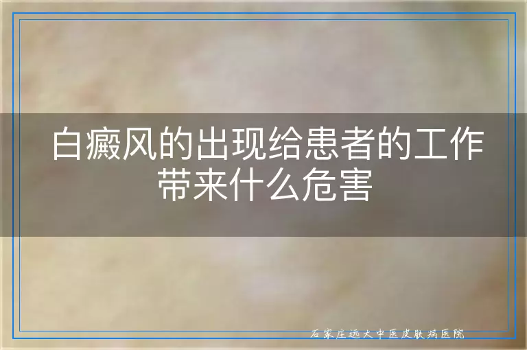 白癜风的出现给患者的工作带来什么危害
