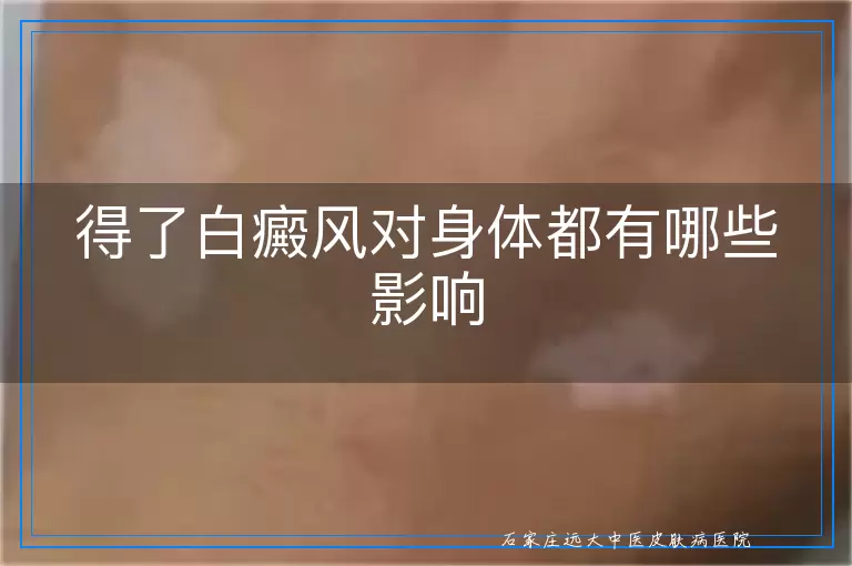 得了白癜风对身体都有哪些影响