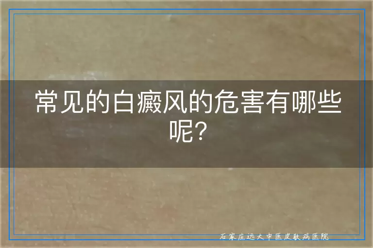 常见的白癜风的危害有哪些呢?