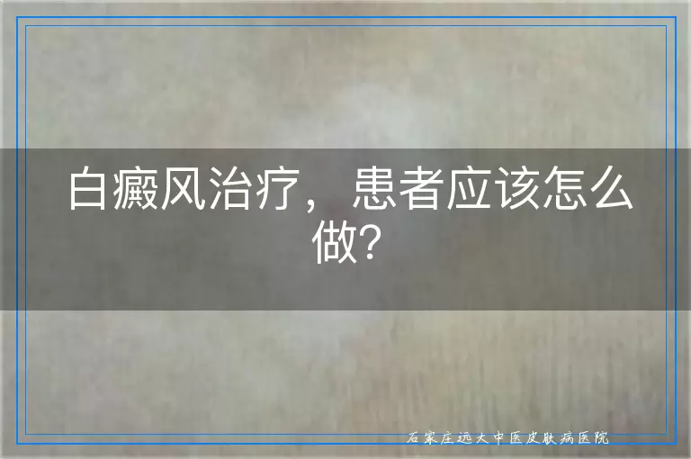 白癜风治疗，患者应该怎么做？