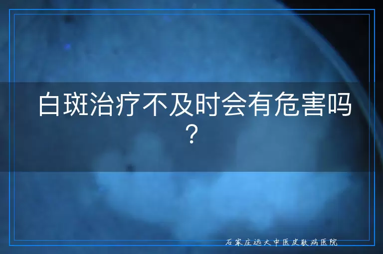 白斑治疗不及时会有危害吗？