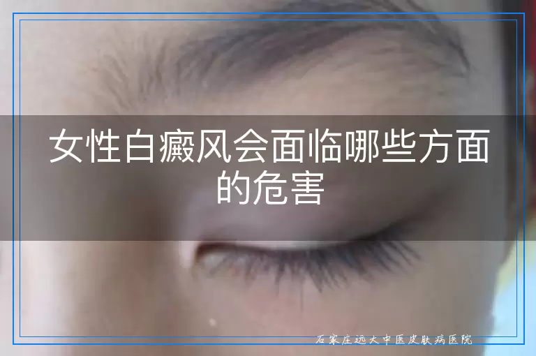 女性白癜风会面临哪些方面的危害