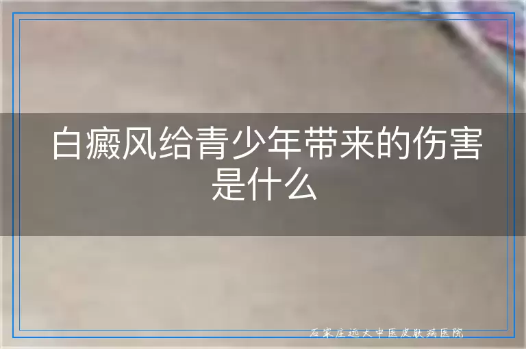 白癜风给青少年带来的伤害是什么