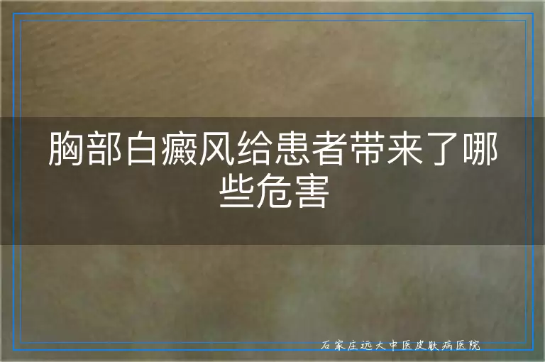 胸部白癜风给患者带来了哪些危害