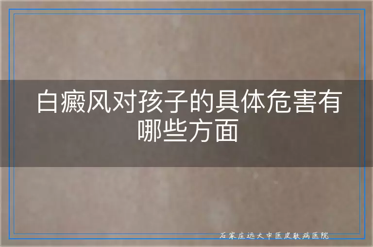 白癜风对孩子的具体危害有哪些方面