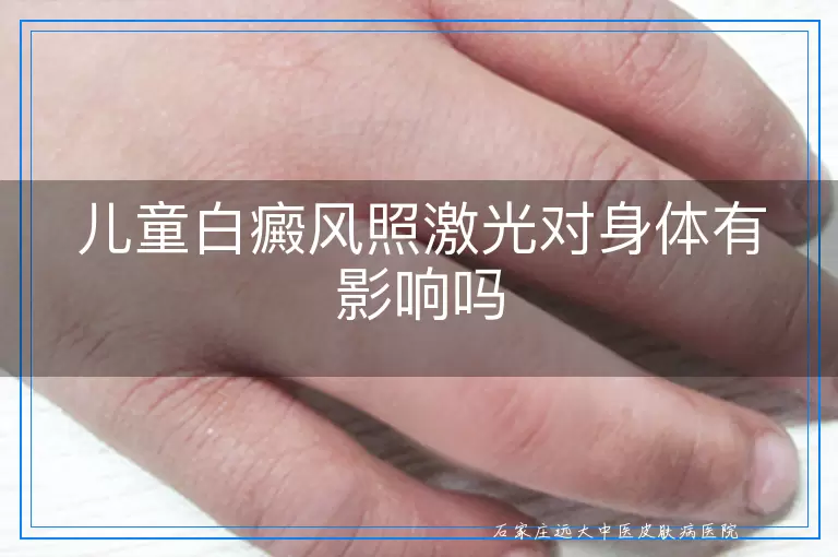儿童白癜风照激光对身体有影响吗