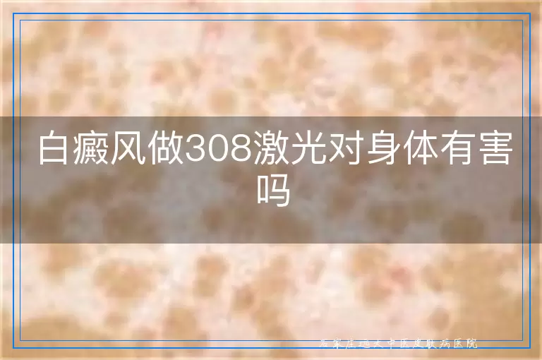 白癜风做308激光对身体有害吗