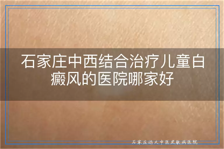 石家庄中西结合治疗儿童白癜风的医院哪家好