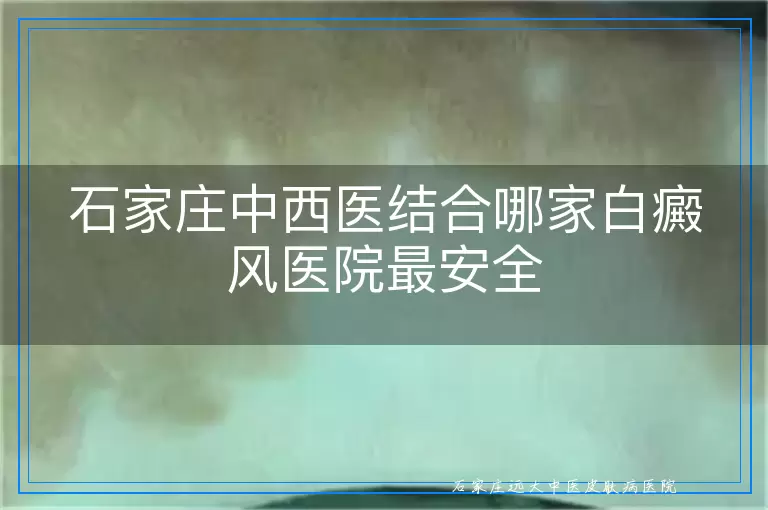 石家庄中西医结合哪家白癜风医院最安全