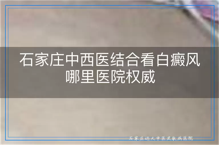 石家庄中西医结合看白癜风哪里医院权威