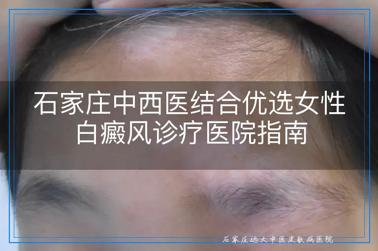 石家庄中西医结合优选女性白癜风诊疗医院指南