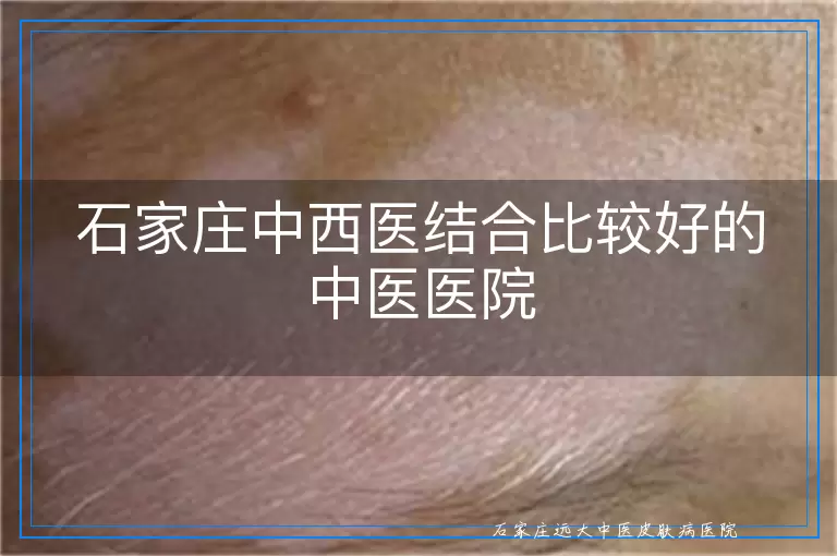 石家庄中西医结合比较好的中医医院