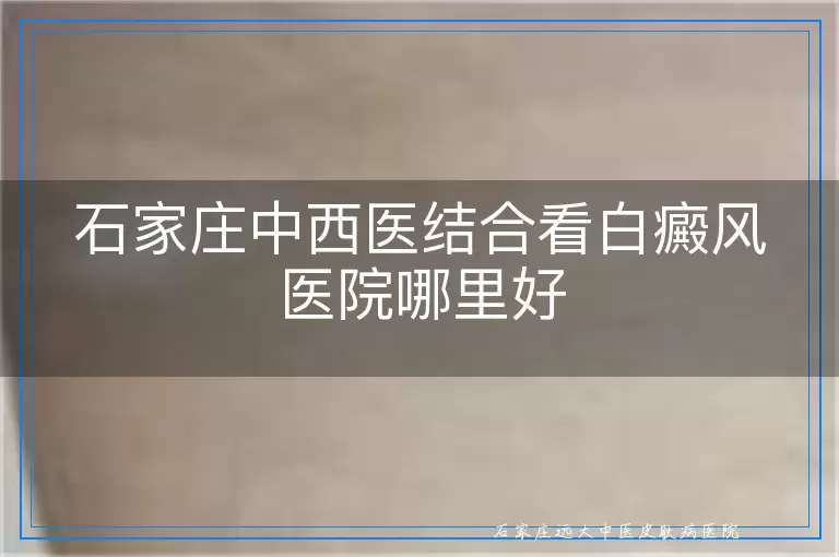 石家庄中西医结合看白癜风医院哪里好