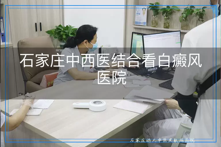 石家庄中西医结合看白癜风医院