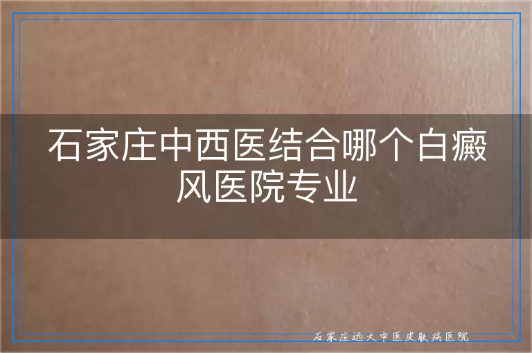 石家庄中西医结合哪个白癜风医院专业
