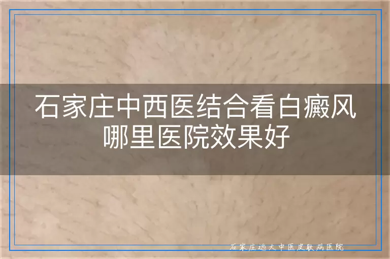 石家庄中西医结合看白癜风哪里医院效果好