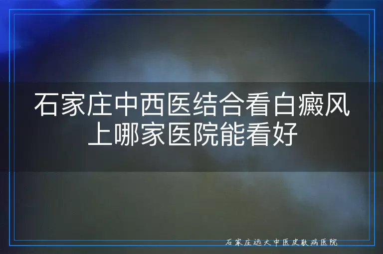 石家庄中西医结合看白癜风上哪家医院能看好