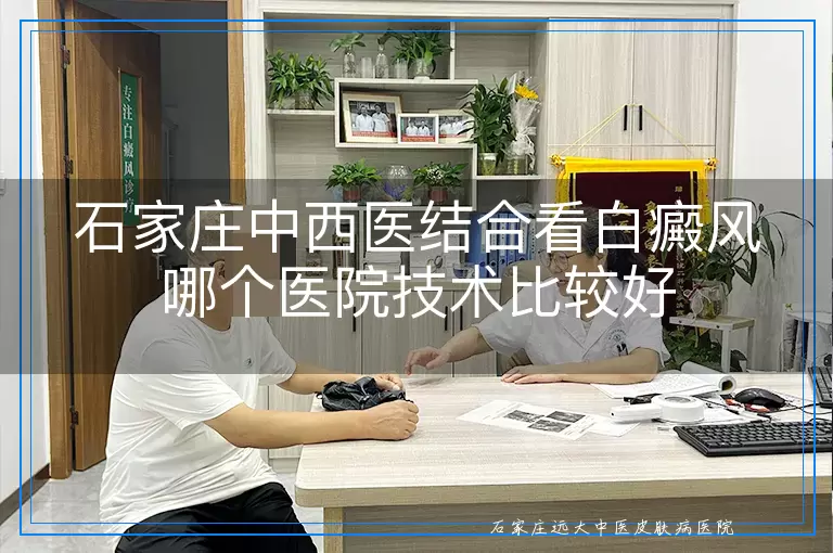 石家庄中西医结合看白癜风哪个医院技术比较好