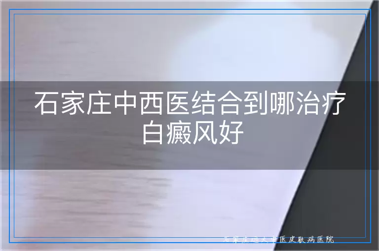 石家庄中西医结合到哪治疗白癜风好