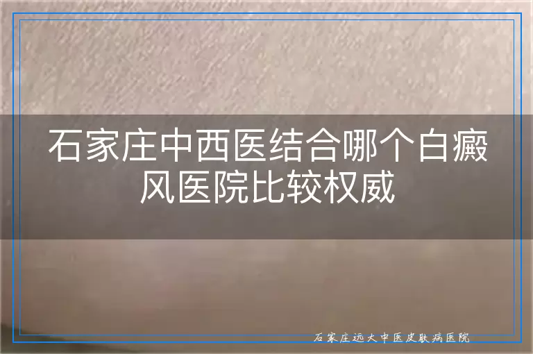 石家庄中西医结合哪个白癜风医院比较权威