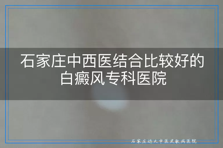 石家庄中西医结合比较好的白癜风专科医院