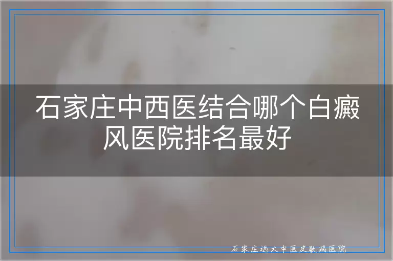 石家庄中西医结合哪个白癜风医院排名最好