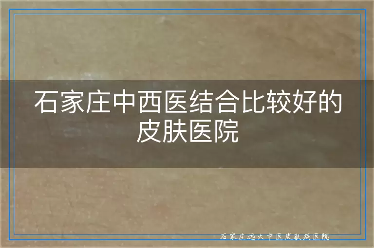 石家庄中西医结合比较好的皮肤医院