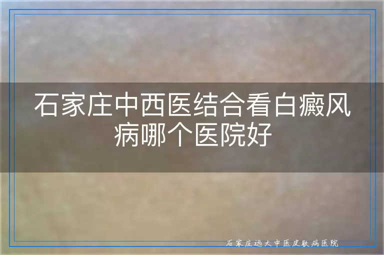 石家庄中西医结合看白癜风病哪个医院好