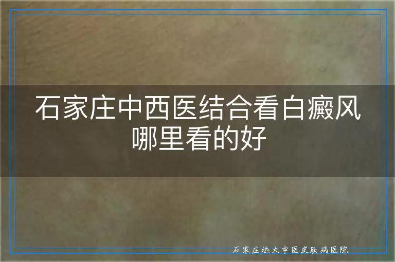 石家庄中西医结合看白癜风哪里看的好