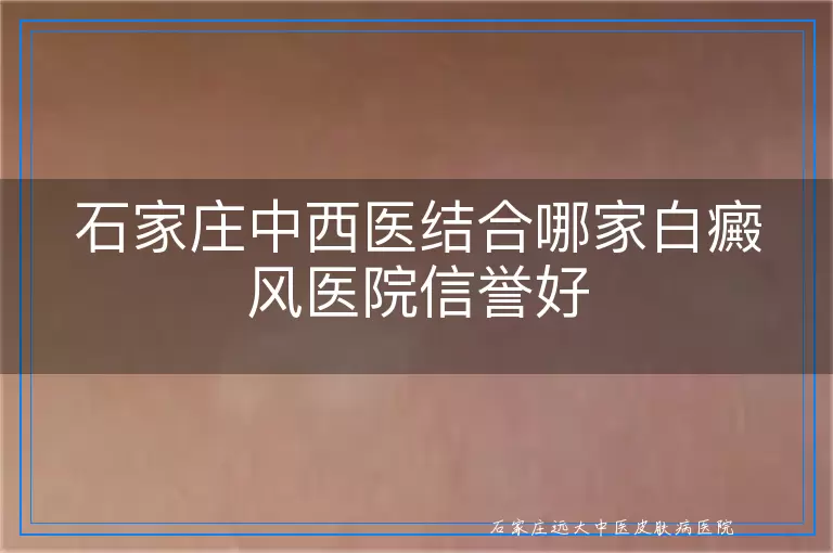 石家庄中西医结合哪家白癜风医院信誉好