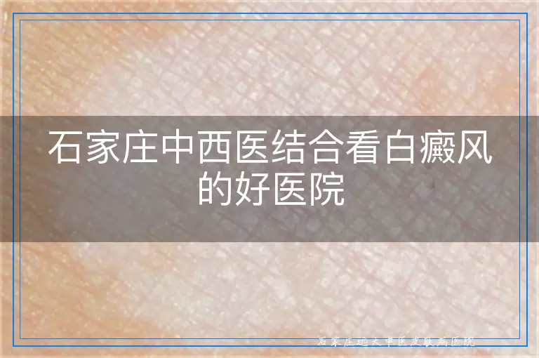 石家庄中西医结合看白癜风的好医院