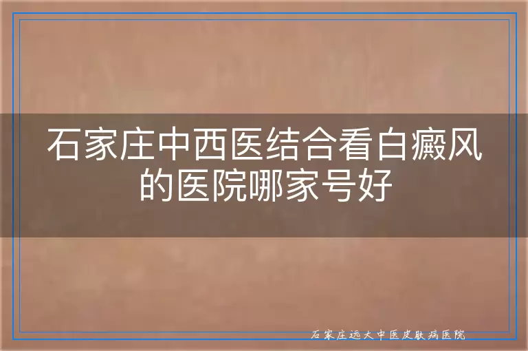 石家庄中西医结合看白癜风的医院哪家号好