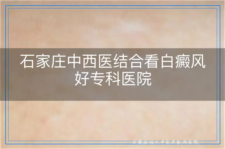 石家庄中西医结合看白癜风好专科医院