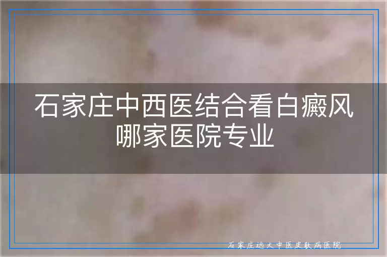 石家庄中西医结合看白癜风哪家医院专业