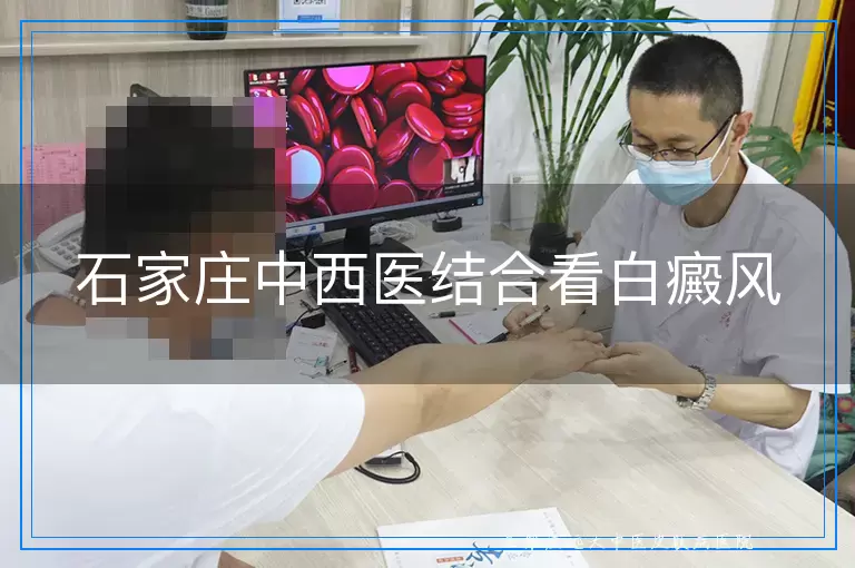 石家庄中西医结合看白癜风