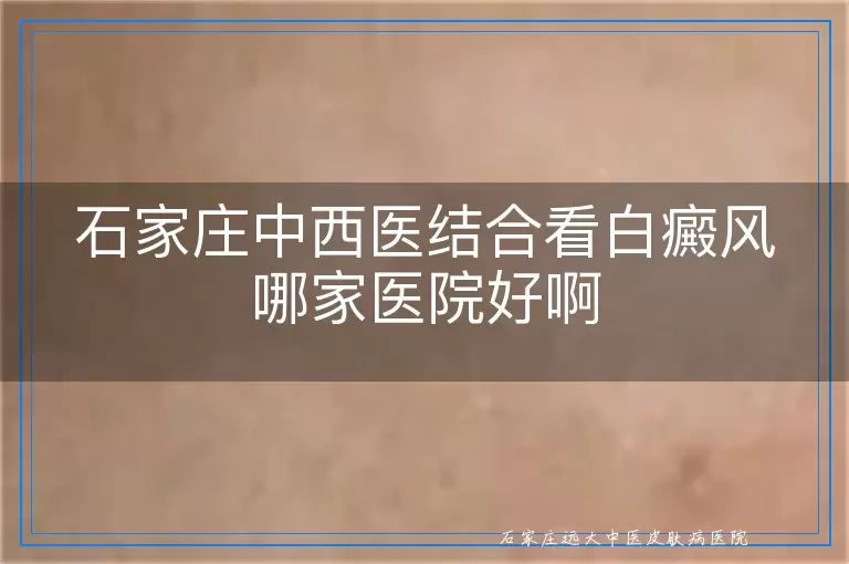 石家庄中西医结合看白癜风哪家医院好啊