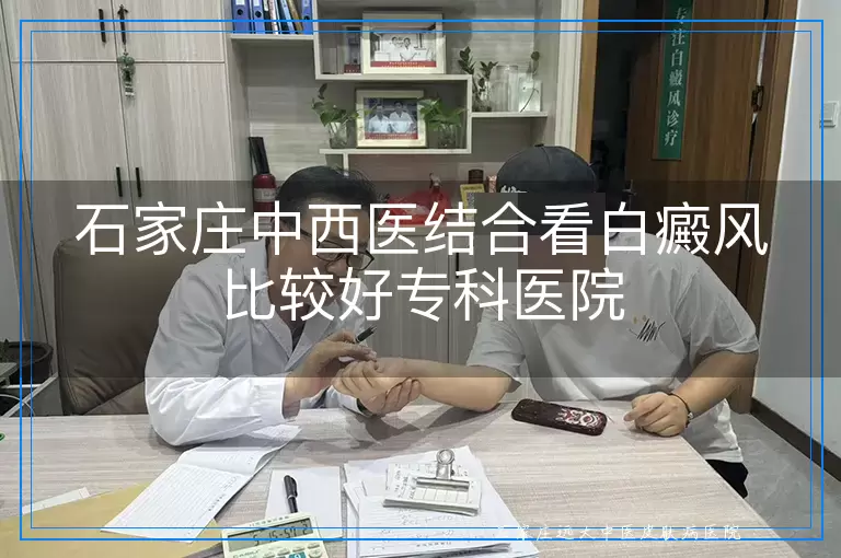 石家庄中西医结合看白癜风比较好专科医院