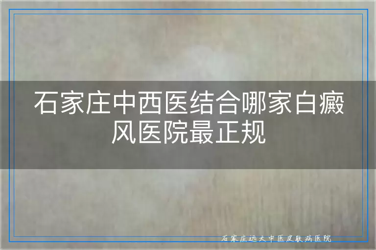 石家庄中西医结合哪家白癜风医院最正规