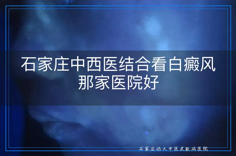 石家庄中西医结合看白癜风那家医院好