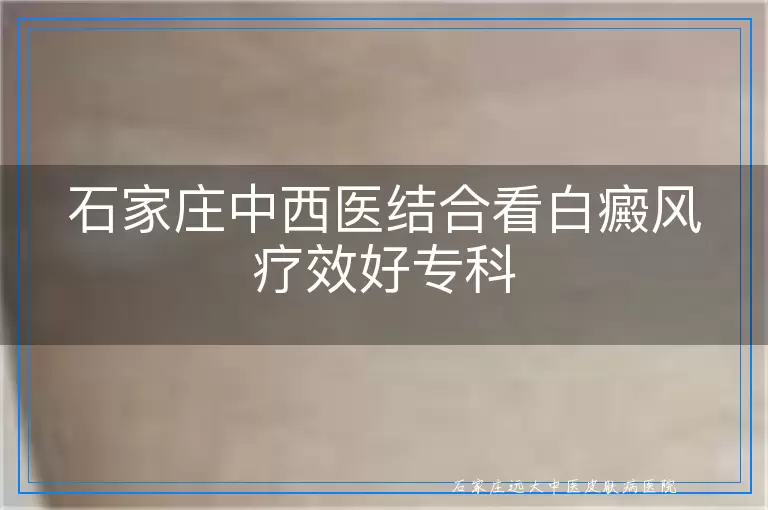 石家庄中西医结合看白癜风疗效好专科