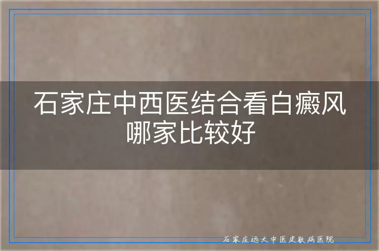 石家庄中西医结合看白癜风哪家比较好