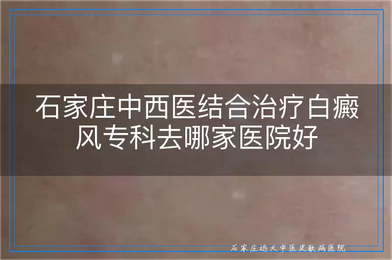 石家庄中西医结合治疗白癜风专科去哪家医院好