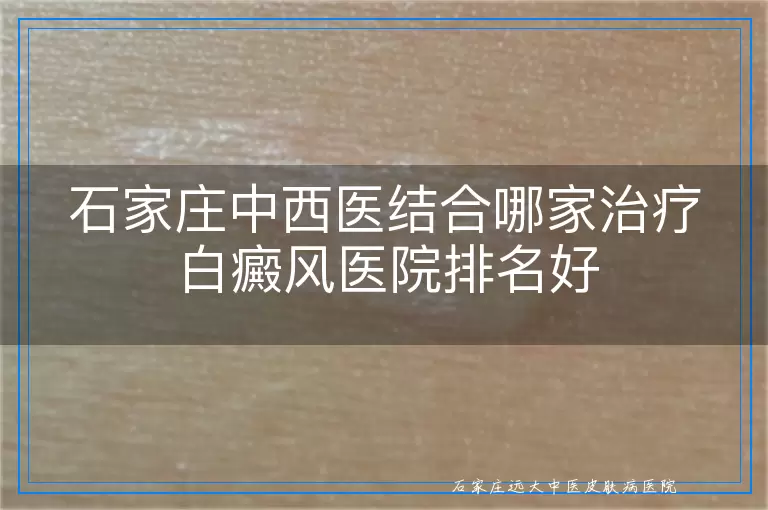 石家庄中西医结合哪家治疗白癜风医院排名好
