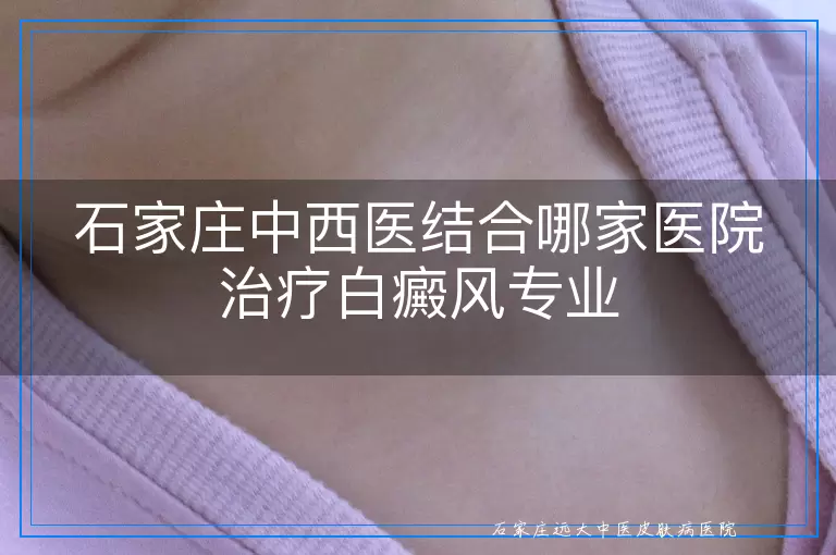 石家庄中西医结合哪家医院治疗白癜风专业