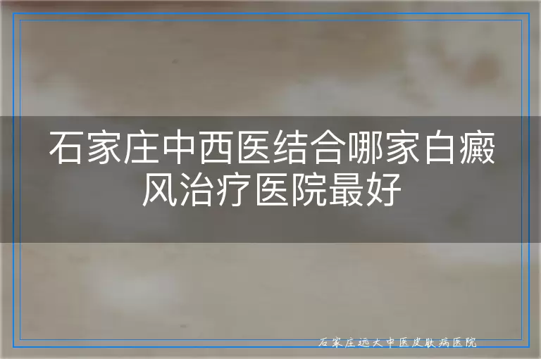 石家庄中西医结合哪家白癜风治疗医院最好
